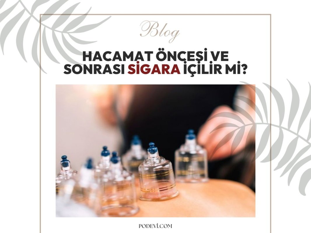 Hacamat Öncesi ve Sonrası Sigara İçilir mi?